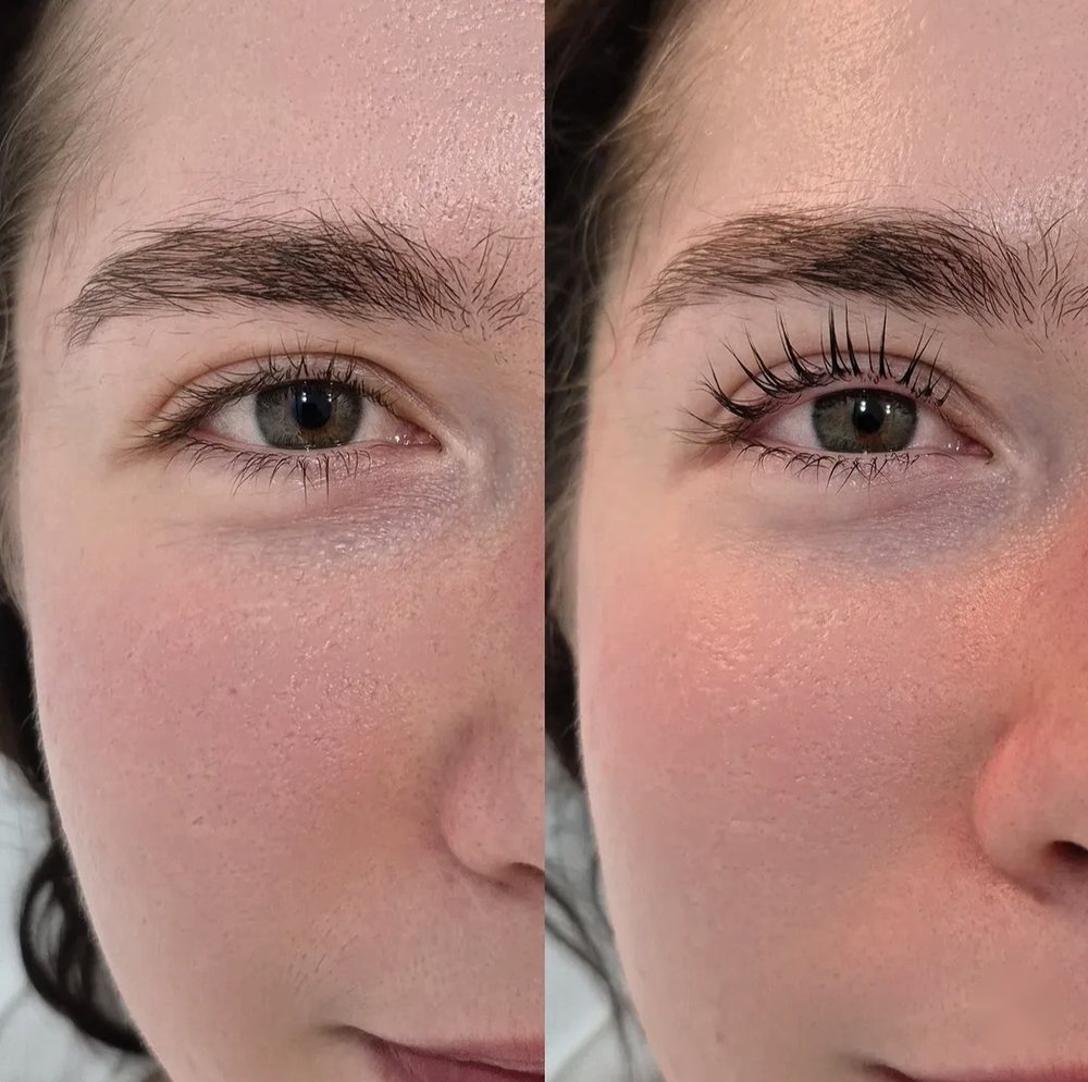 Wimpern vor und nach dem Wimpernlifting